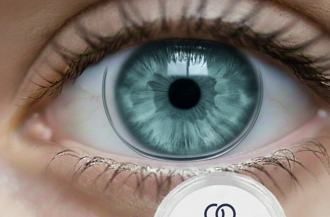 lentilles de contact - Espace Vision